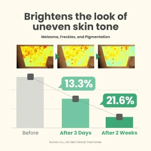 خرید و قیمت سرم ضدلک شفاف کننده و از بین برنده جای جوش دارک اسپات اکسیس وای اکسیس وای AXIS-Y Dark Spot Correcting Glow Serum حجم 50 میلی لیتر