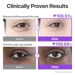 خرید و قیمت پچ زیر چشم + NAD و کلاژن شماره ۹ ضد چروک ضد پف و تیرگی نامبوزین Numbuzin No.9 NAD+ Collagen Under Eye