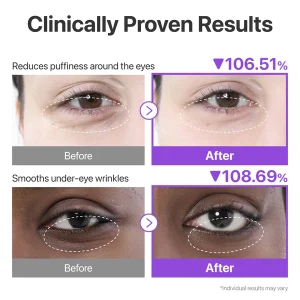 خرید و قیمت پچ زیر چشم + NAD و کلاژن شماره ۹ ضد چروک ضد پف و تیرگی نامبوزین Numbuzin No.9 NAD+ Collagen Under Eye