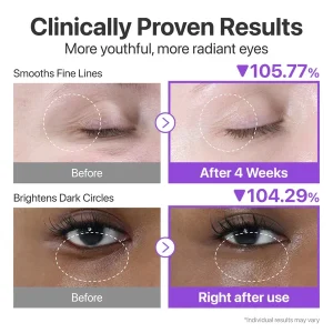 خرید و قیمت کرم دور چشم +NAD و رتینول ضدچروک و روشن کننده شماره ۹ نامبوزین numbuzin NAD+ Retinol Volumetox Eye Cream حجم 10 میلی لیتر