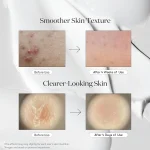 خرید و قیمت اسنس تقویت کننده و تسکین دهنده ریدل شات 100 وی تی کازمتیک VT COSMETICS CICA Reedle Shot Essence حجم 50 میلی لیتر