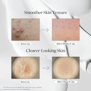 خرید و قیمت اسنس تقویت کننده و تسکین دهنده ریدل شات 100 وی تی کازمتیک VT COSMETICS CICA Reedle Shot Essence حجم 50 میلی لیتر