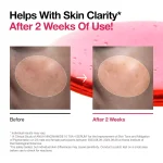 خرید و قیمت سرم ضد لک نیاسینامید %۱۰ + ترانگزامیک اسید ۴ آنوا Anua Niacinamide 10% + TXA ۴% Dark Spot Correcting Serum حجم 30 میلی لیتر