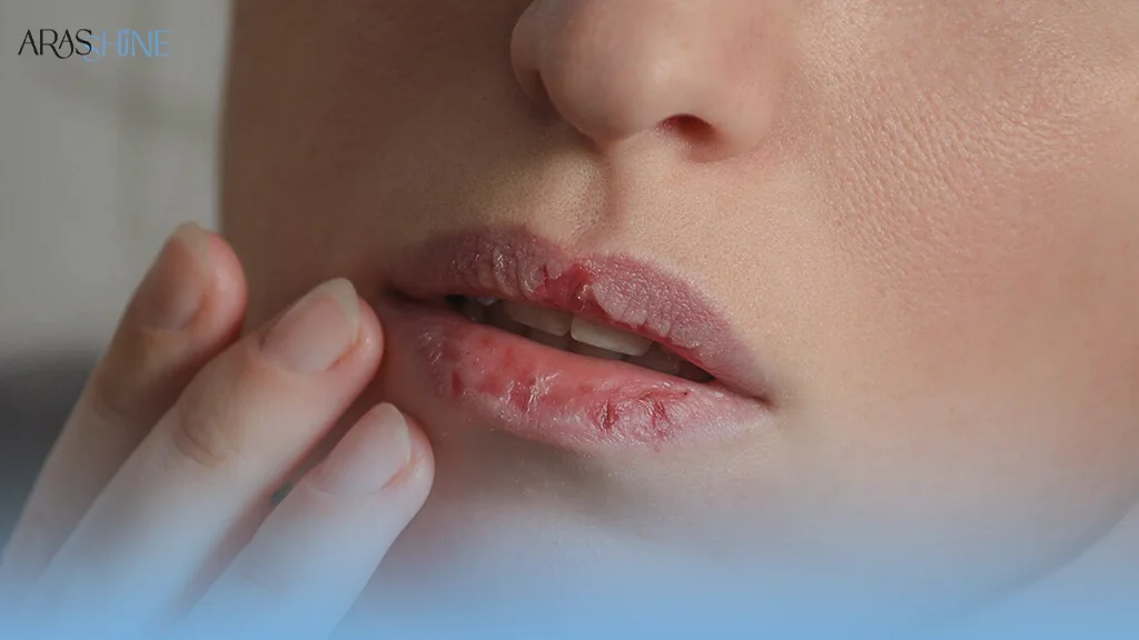 کاهش رطوبت هوا