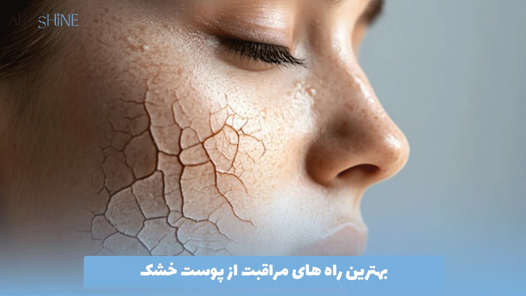 بهترین راه‌ های مراقبت از پوست خشک