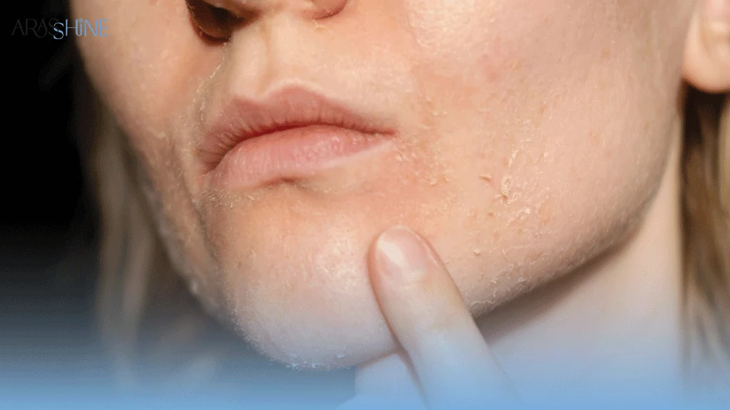 پوست خشک چه علائمی دارد که نباید نادیده بگیرید؟