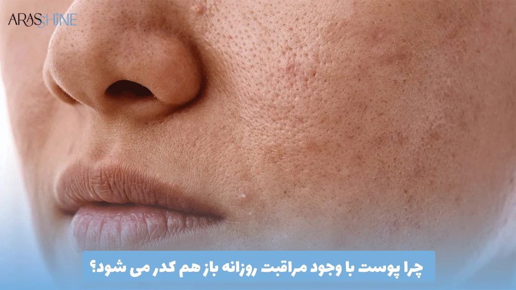 چرا پوست با وجود مراقبت روزانه باز هم کدر می ‌شود؟