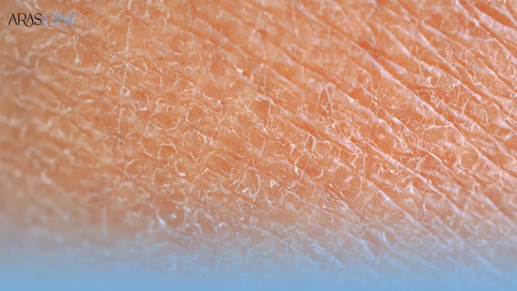 کم آبی چه تاثیری روی شادابی پوست می گذارد؟