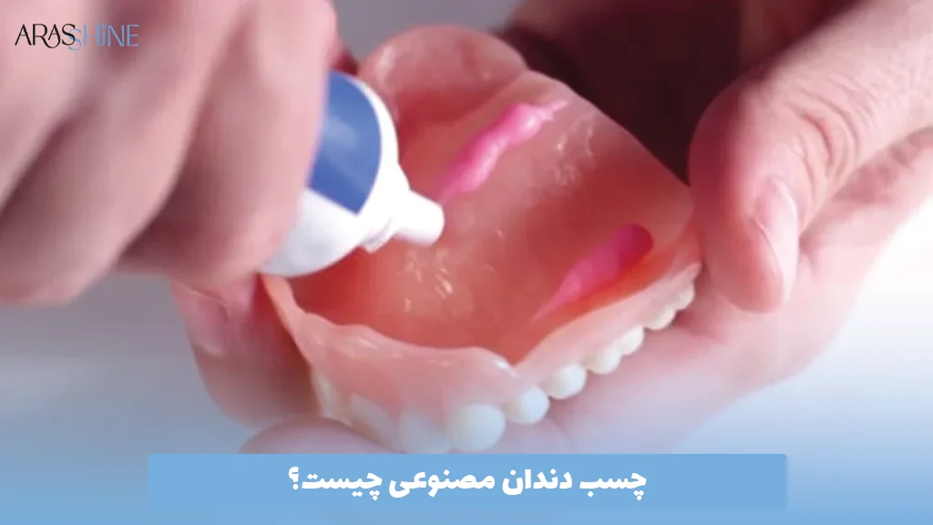چسب دندان مصنوعی چیست؟